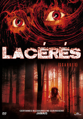 Lacérés