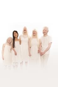 Watch Born with Albinism