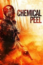 Watch Chemical Peel