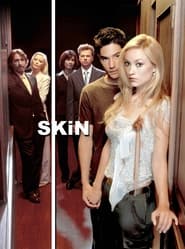 Watch Skin