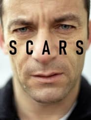 Watch Scars