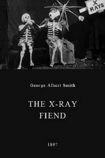 Watch The X-Ray Fiend
