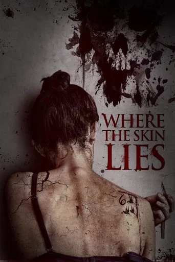 Watch Where the Skin Lies