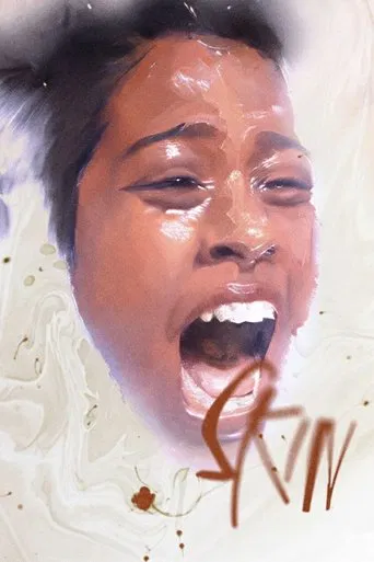 Skin