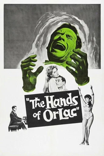 Las manos de Orlac