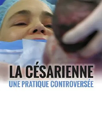 La césarienne - une pratique controversée
